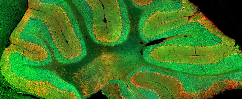 Image of cerebellum with granule cells demarcated in green.