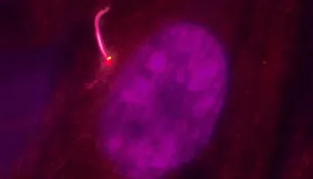 Photo of a retinal pigmented epithelial cell, with the nucleus in magenta and cilium in pink.