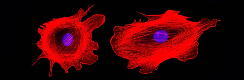 Confocal microscopy imaging of two cancer cells with cytoskeletal protein actin highlighted in red, showing structure.