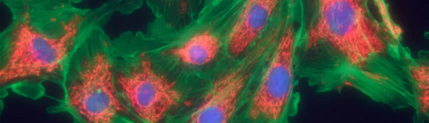 Graphic image of fibroblast cells with cell components colored.
