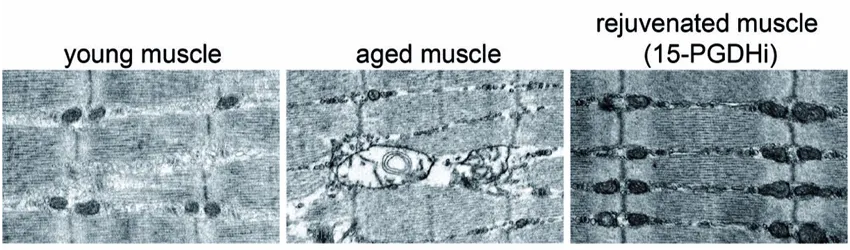 Compilation of 3 labeled images: first image is of "young muscle", showing grid of interconnected fibers; second is of "aged muscle", which shows damage in the center where fibers have disconnected and there are gaps; third image is "rejuvenated muscle", which shows more tightly woven structure similar to the young muscle.