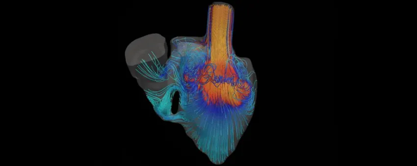 Graphic image of Dr. Marsden's blood flow simulator, showing colorful simulated flows moving through a heart.
