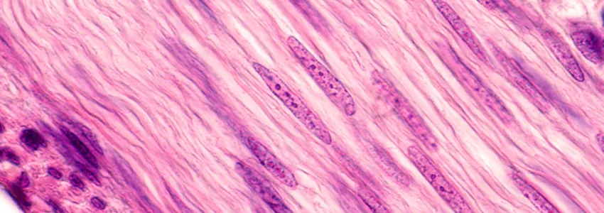 Image of smooth muscle cells in pink, with long nuclei showing darker purple.