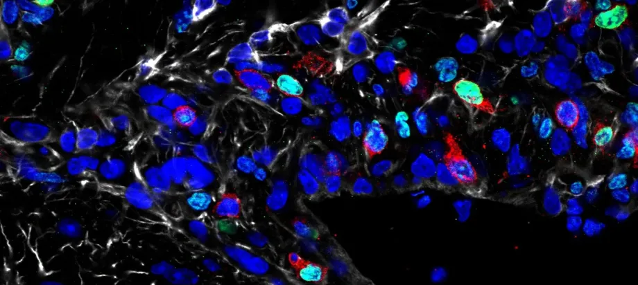 Microscope image of numerous cells, most of them dark blue.