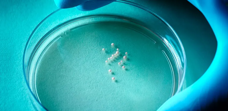 Photo showing tiny white spheres in a petri dish, which are the developing organoids.