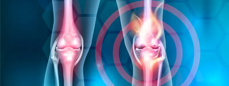 Graphic 3d image showing person's knees, with one circled in red, against abstract background.