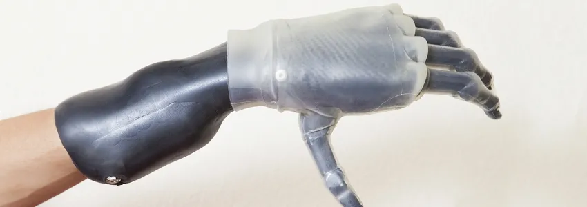 Photo of a prosthetic hand.