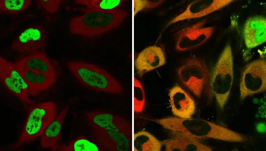 Image showing cells, with left side showing more green glowing cells and the right showing more cells that are not glowing green.