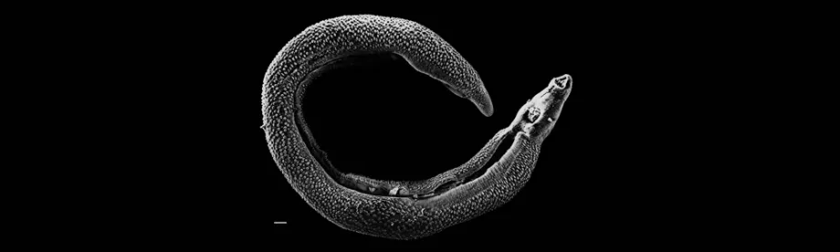 Photo of parasitic worm.