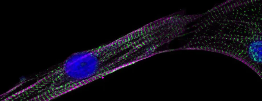 Image of a long tube-shaped cell with a bright blue area.