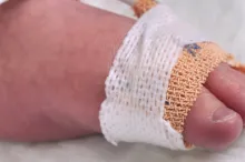 Photo of a baby's foot wrapped with a bandage to secure a tube.